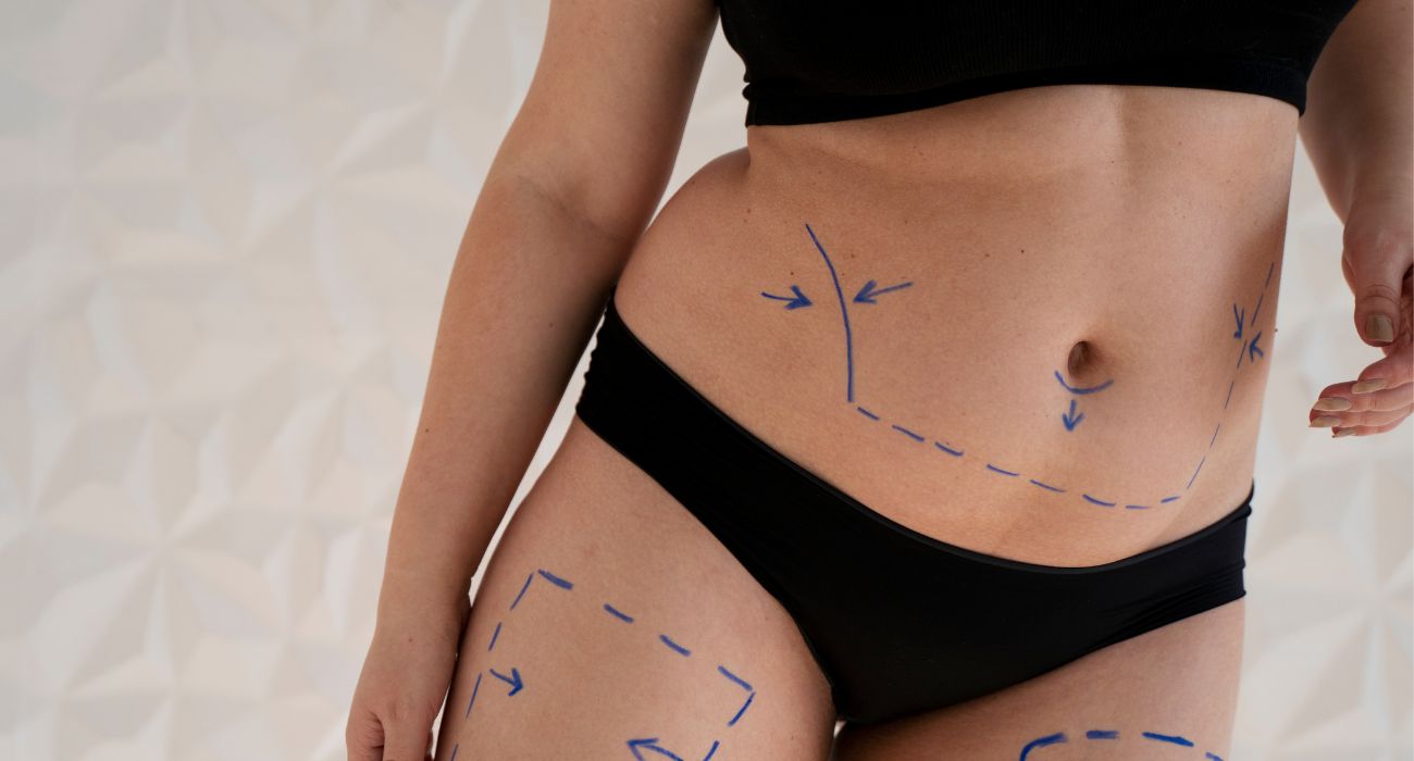 ¿Te has operado recientemente? Practicar deporte tras una cirugía estética requiere tiempos y cuidados específicos para evitar complicaciones.